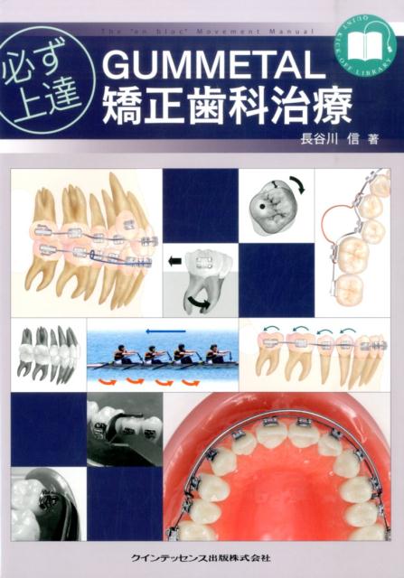 必ず上達GUMMETAL矯正歯科治療