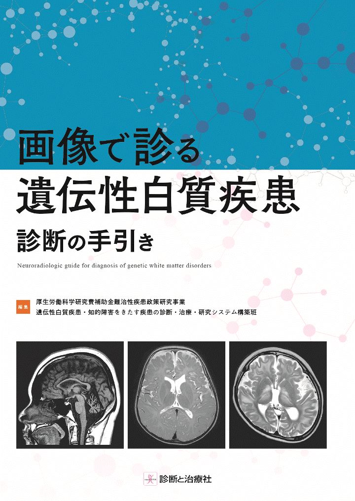 画像で診る遺伝性白質疾患 診断の手引き [ 厚生労働科学研究費補助金難治性疾患政策研究事業遺伝性白質疾患・知的障害をきたす疾患の診断・治療・研究システム構築班 ]