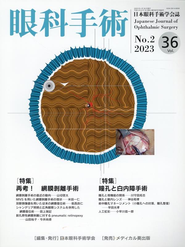 眼科手術（Vol．36 No．2（202）