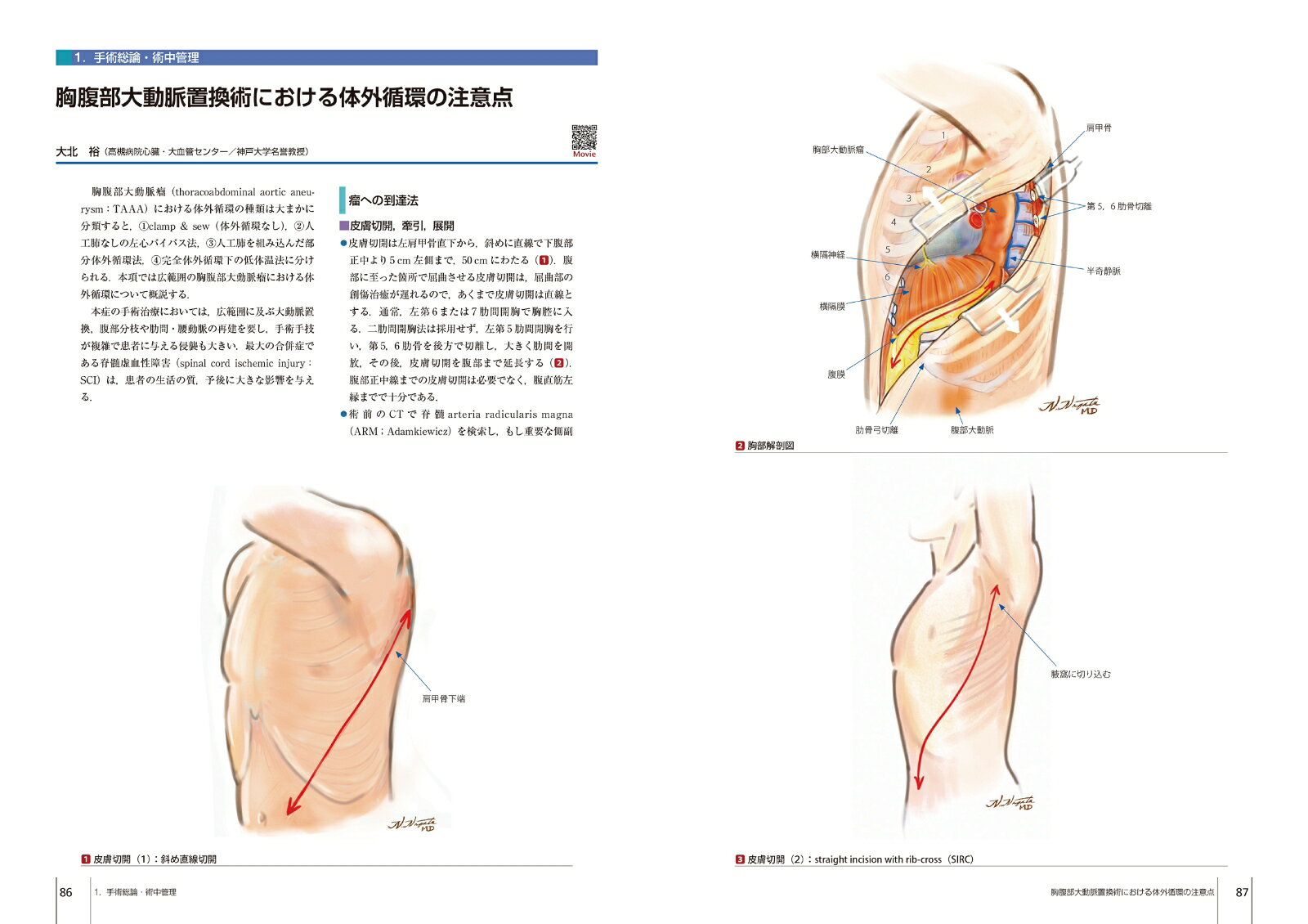 心臓血管外科手術基本手技（第1巻） （心臓血管外科手術エクセレンス） [ 坂東　興 ] 3