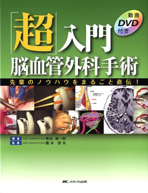 「超」入門脳血管外科手術