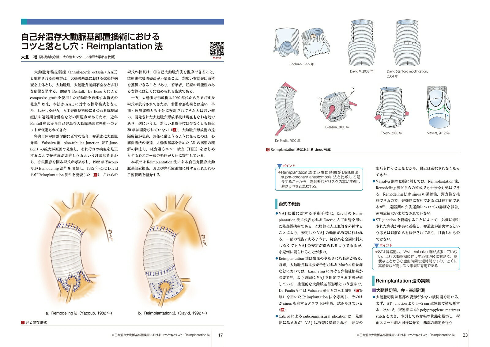大動脈疾患の手術（第4巻） （心臓血管外科手術エクセレンス） [ 大北裕 ] 2