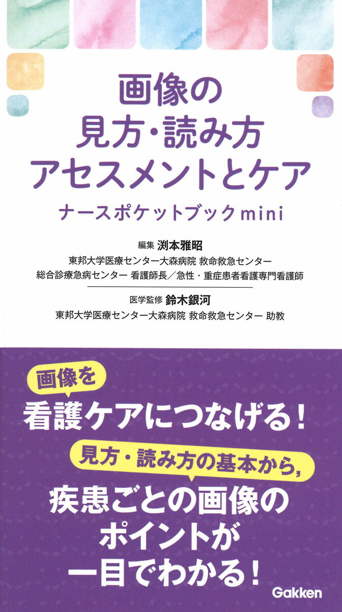 画像の見方・読み方アセスメントとケアナースポケットブックmini