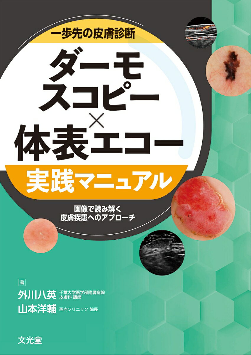 一歩先の皮膚診断 ダーモスコピー×体表エコー実践マニュアル 画像で読み解く皮膚疾患へのアプローチ