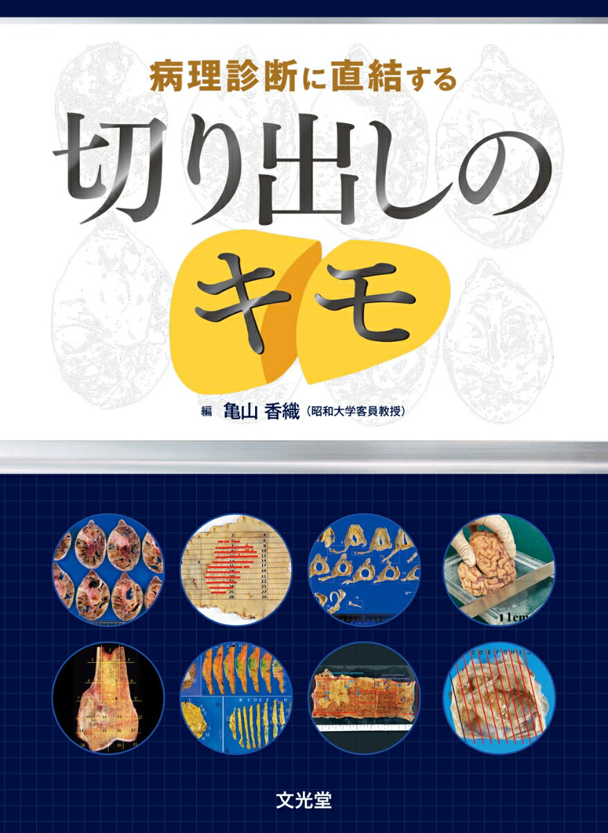 病理診断に直結する切り出しのキモ 亀山香織