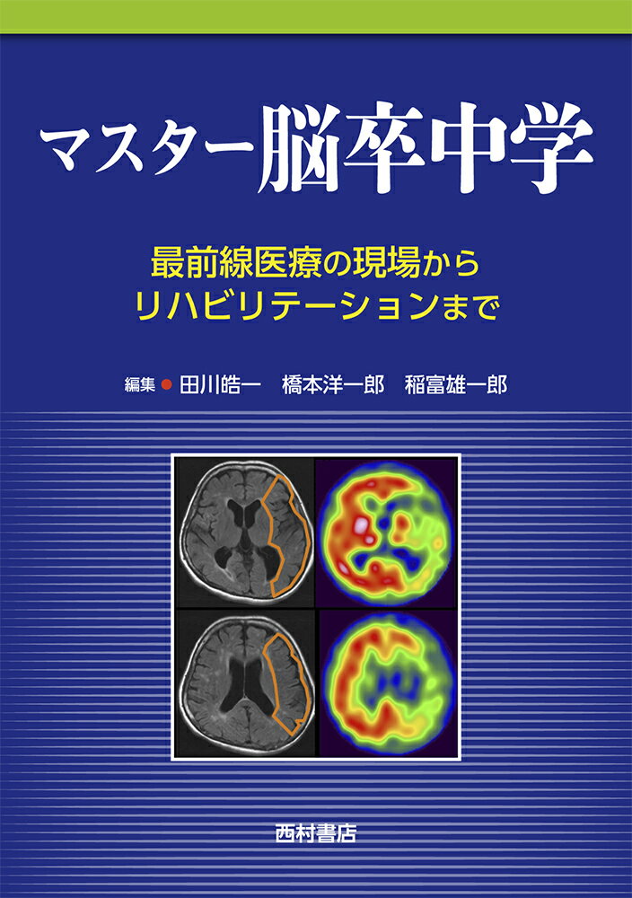 マスター脳卒中学