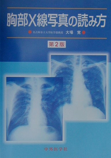 胸部X線写真の読み方第2版