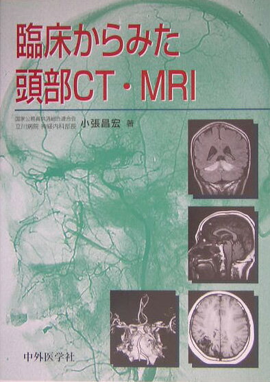 臨床からみた頭部CT・MRI [ 小張昌宏 ]
