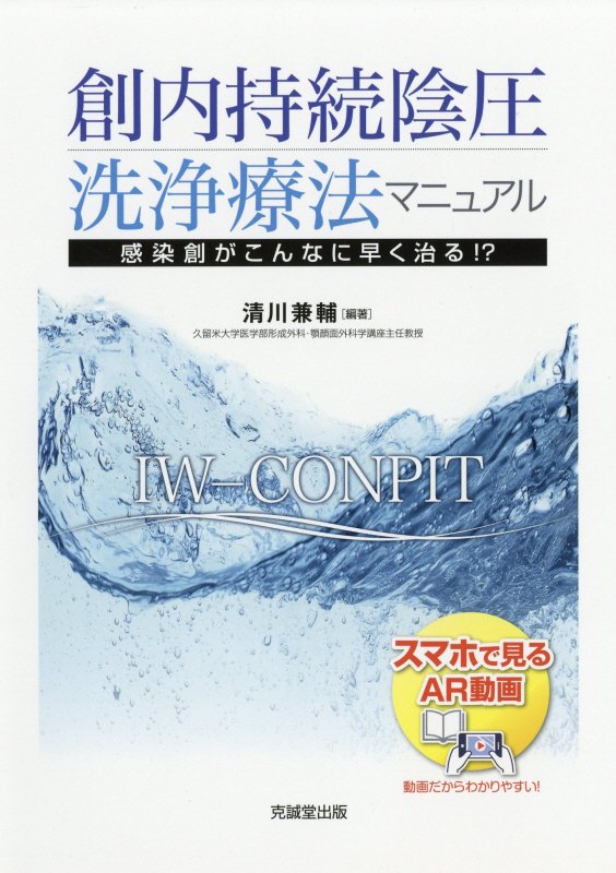 創内持続陰圧洗浄療法マニュアル