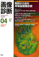 画像診断2018年4月号 Vol.38 No.5