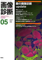 画像診断2018年5月号 Vol.38 No.6