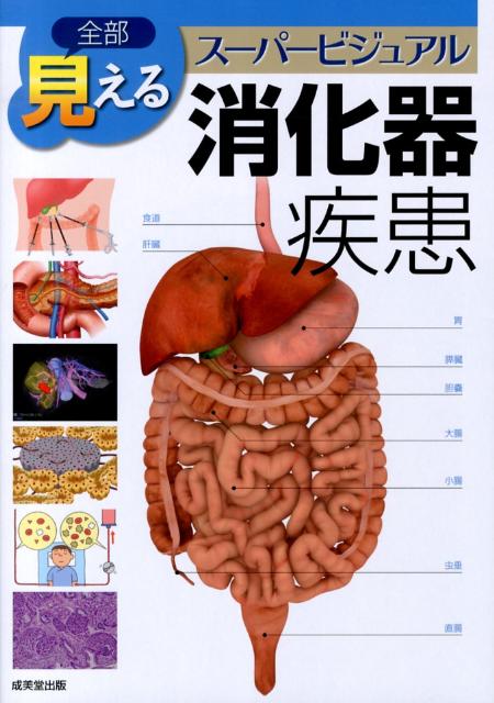 全部見える消化器疾患