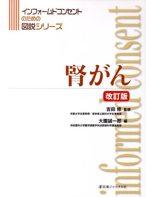 腎がん　改訂版