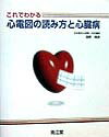 これでわかる心電図の読み方と心臓病