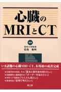 心臓のMRIとCT