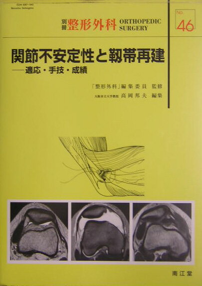 関節不安定性と靭帯再建