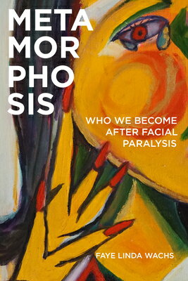 Metamorphosis: Who We Become After Facial Paralysis METAMORPHOSIS [ Faye Linda Wachs ]