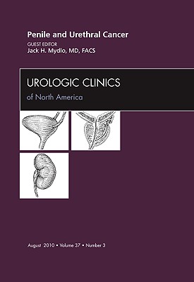 Dr. Mydlo's issue provides a comprehensive review of the diagnosis, management, and treatment of penile and urethral cancer. Top experts in the field have supplied state-of-the-art clinical reviews devoted to core issues, such as Premalignant and early carcinomas of the penis and scrotum; Histopathology of malignant lesions of the penis and urethra; Penile cancer: clinical presentation, diagnosis and staging; Reconstruction of the penis after surgery; Micrographic surgery for penile tumors; Management of regional lymphatic drainage; Radiation therapy of cancer of the penis; and Cancer of male/female urethra.