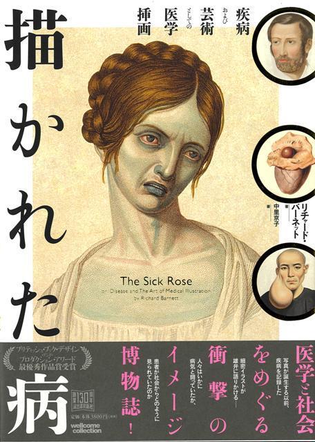 【バーゲン本】描かれた病ー疾病および芸術としての医学挿画