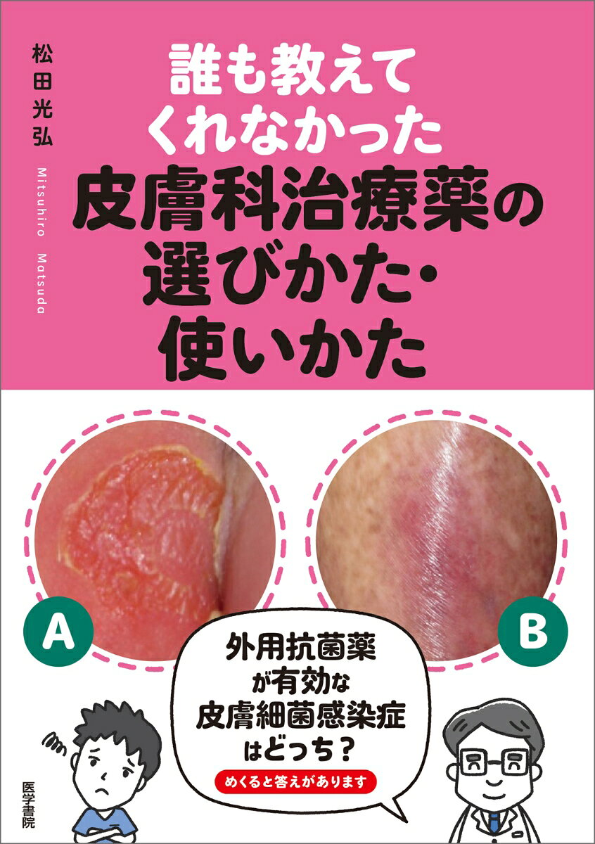 誰も教えてくれなかった皮膚科治療薬の選びかた・使いかたの表紙