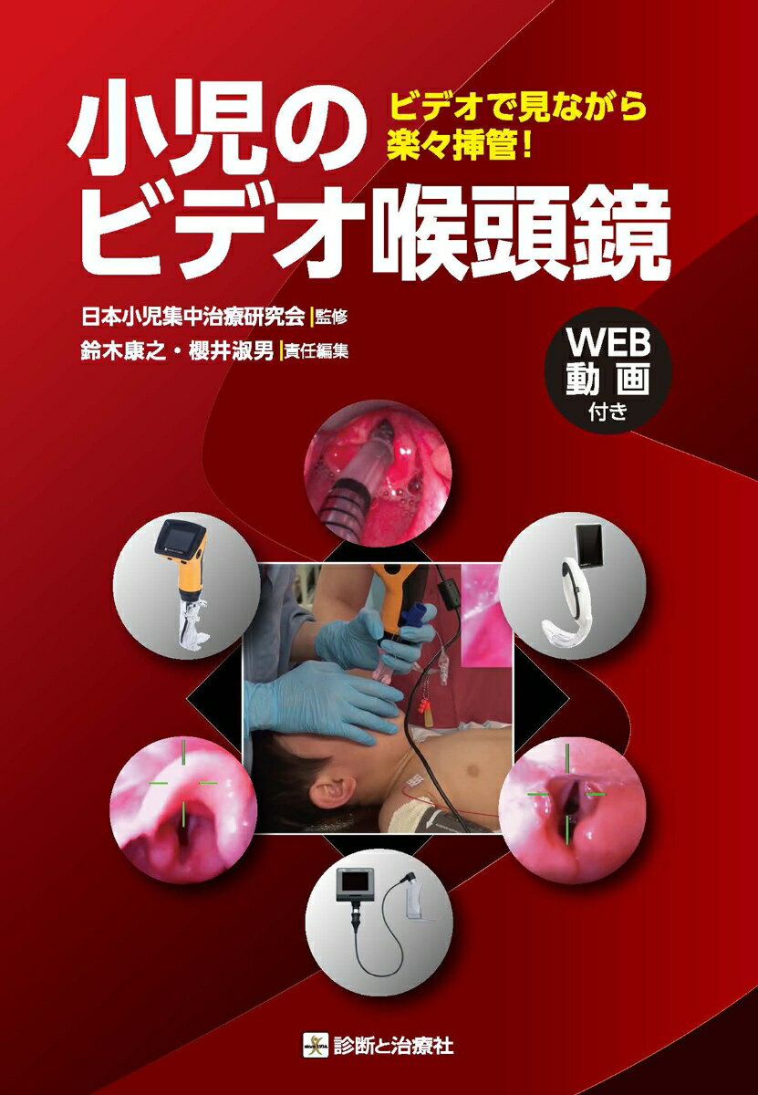 小児のビデオ喉頭鏡　ビデオで見ながら楽々挿管！