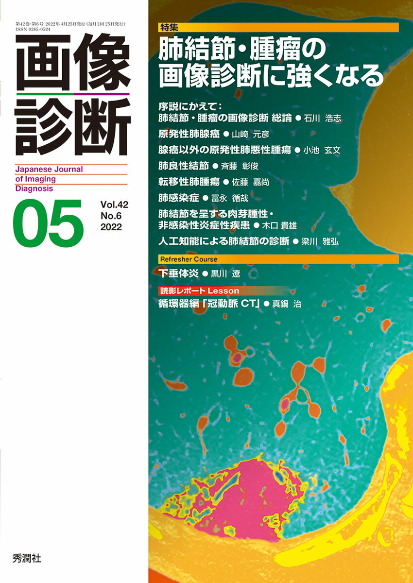 画像診断2022年5月号 Vol．42 No．6