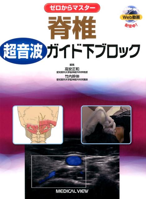 ゼロからマスター脊椎超音波ガイド下ブロック