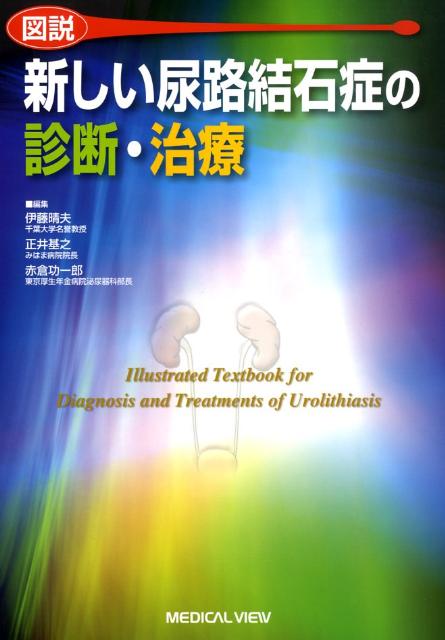図説新しい尿路結石症の診断・治療