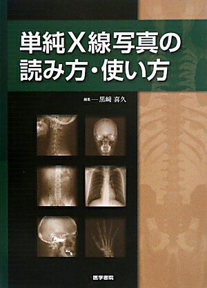 単純X線写真の読み方・使い方