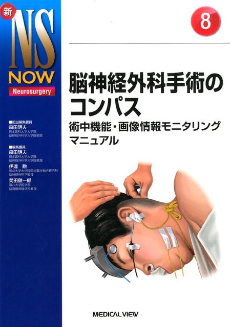 脳神経外科手術のコンパス