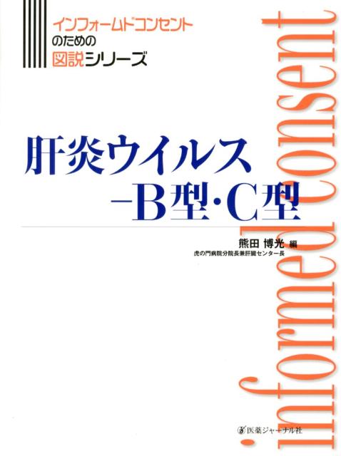 肝炎ウイルスーB型・C型 （インフォームドコンセントのための図説シリーズ） [ 熊田　博光 ]