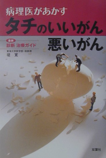 病理医があかすタチのいいがん悪いがん