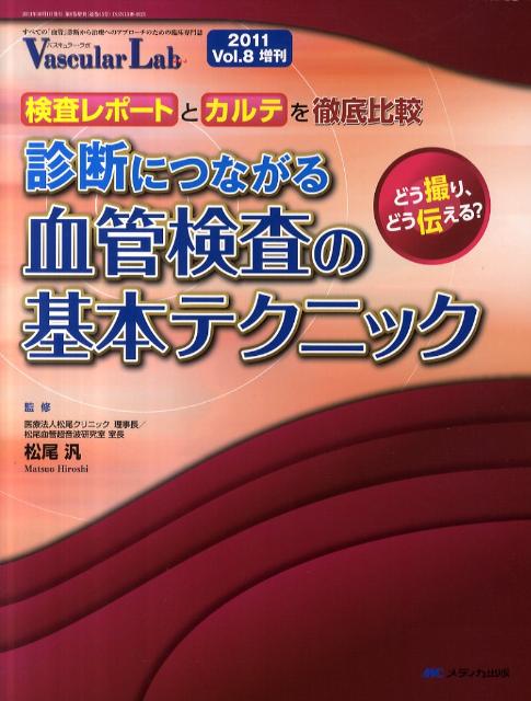 診断につながる血管検査の基本テクニック