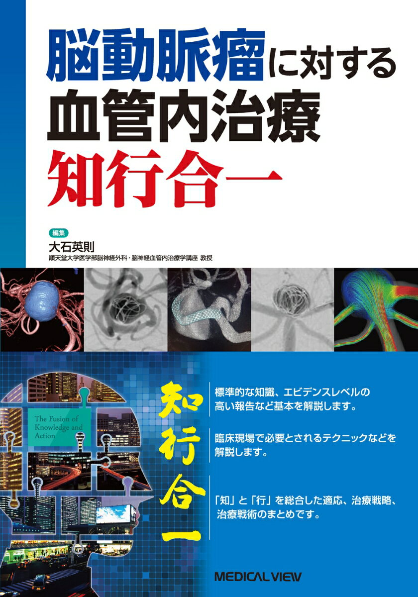 脳動脈瘤に対する血管内治療　知行合一 [ 大石　英則 ]