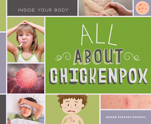 All about Chickenpox ALL ABT CHICKENPOX （Inside Your Body Set 2） [ Megan Borgert-Spaniol ]