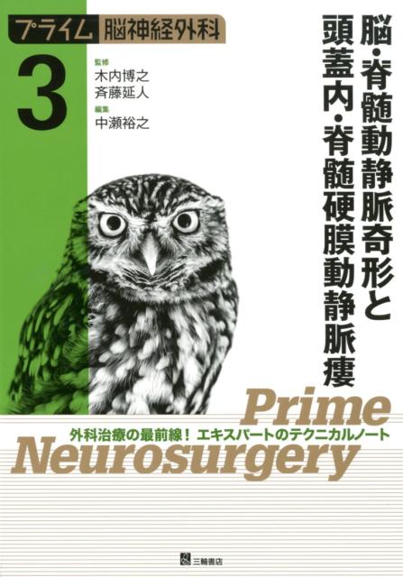 脳・脊髄動静脈奇形と頭蓋内・脊髄硬膜動静脈瘻