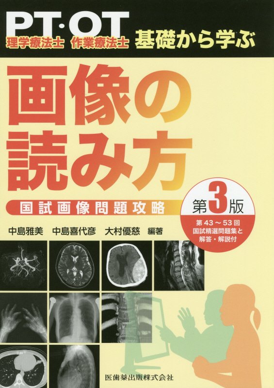 理学療法士・作業療法士PT・OT基礎から学ぶ画像の読み方国試画像問題攻略第3版