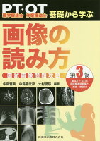 理学療法士・作業療法士PT・OT基礎から学ぶ画像の読み方国試画像問題攻略第3版