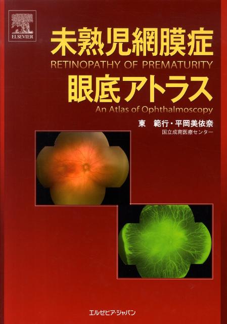 未熟児網膜症眼底アトラス