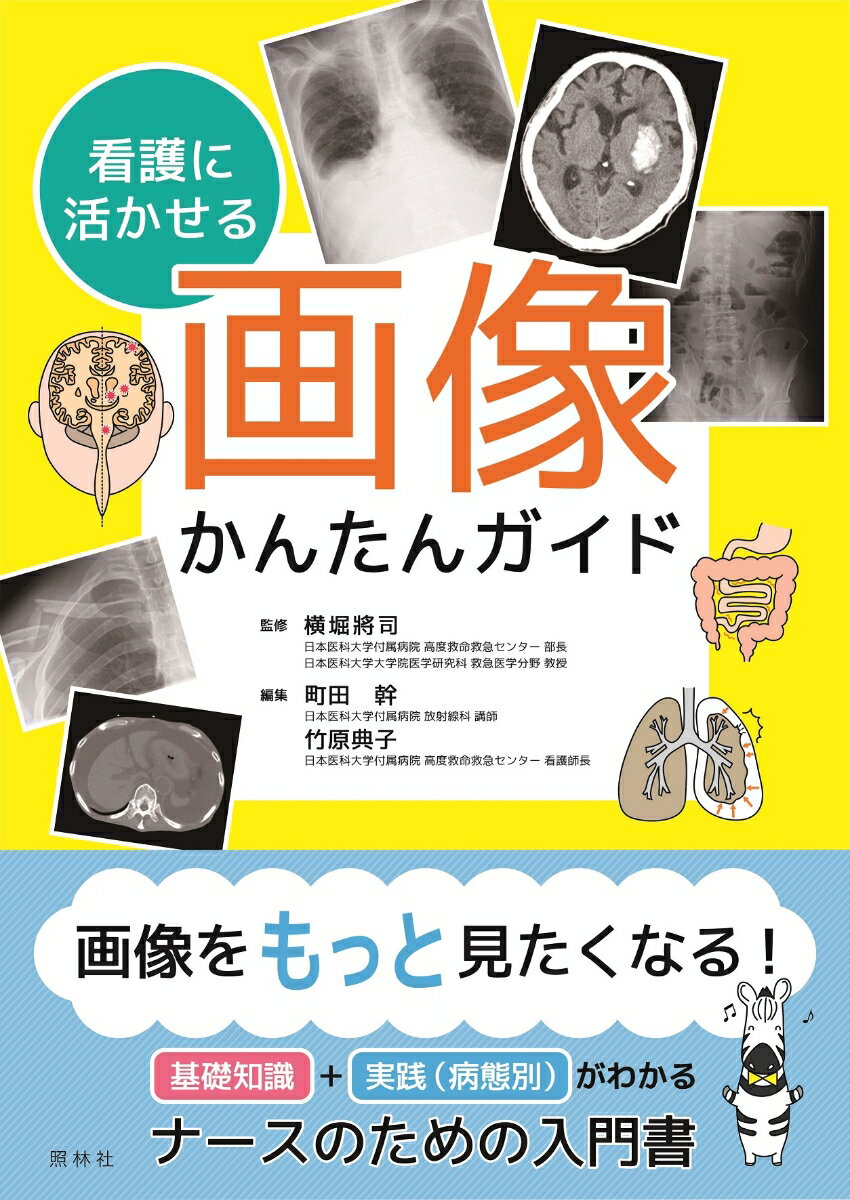 画像をもっと見たくなる！基礎知識＋実践（病態別）がわかるナースのための入門書。