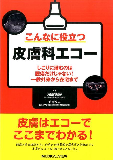 皮膚科領域で役立つ“皮膚科エコー”の撮り方、読み取り方を簡潔解説。ｃａｓｅ別に臨床所見、超音波所見、ＭＲＩ所見、病理所見、診断、疾患の基礎知識にわけて掲載。エコー所見も比較して解説した皮膚科エコーの集大成！