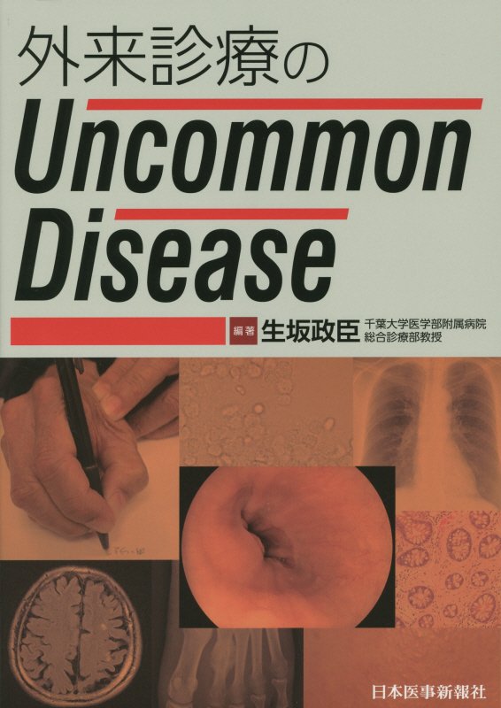 外来診療のUncommon　Disease [ 生坂政臣 ]