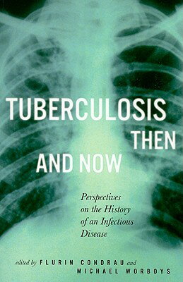Tuberculosis Then and Now: Perspectives on the History of an Infectious Disease Volume 36 TUBERCULOSIS THEN & NOW （McGill-Queen's/Ams Healthcare Studies in the History of Medicine, Health, and Society） [ Flurin Condrau ]