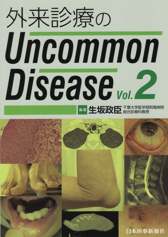 外来診療のUncommon Disease（Vol．2） 生坂政臣