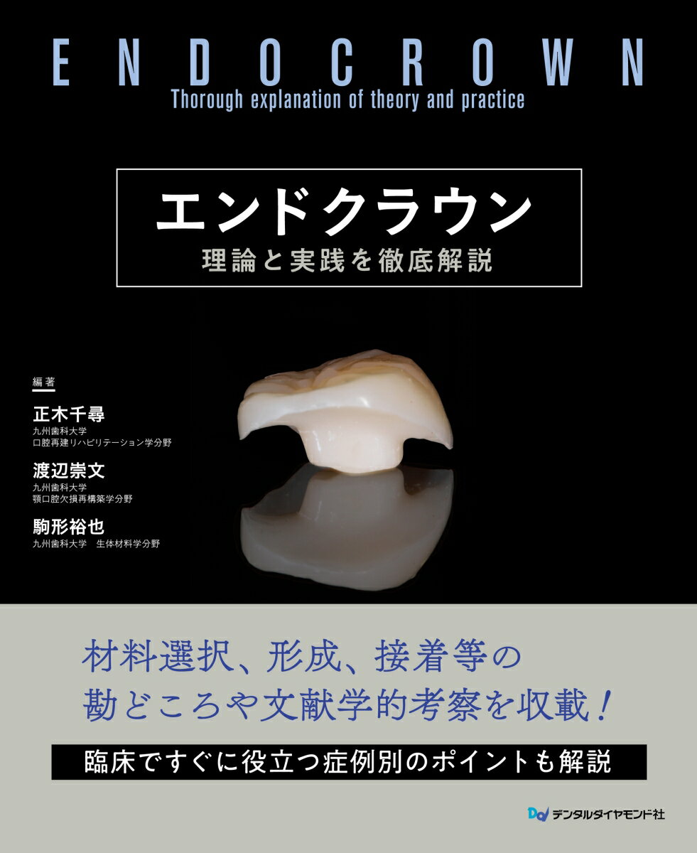 エンドクラウン 理論と実践を徹底解説 [ 正木千尋 ]