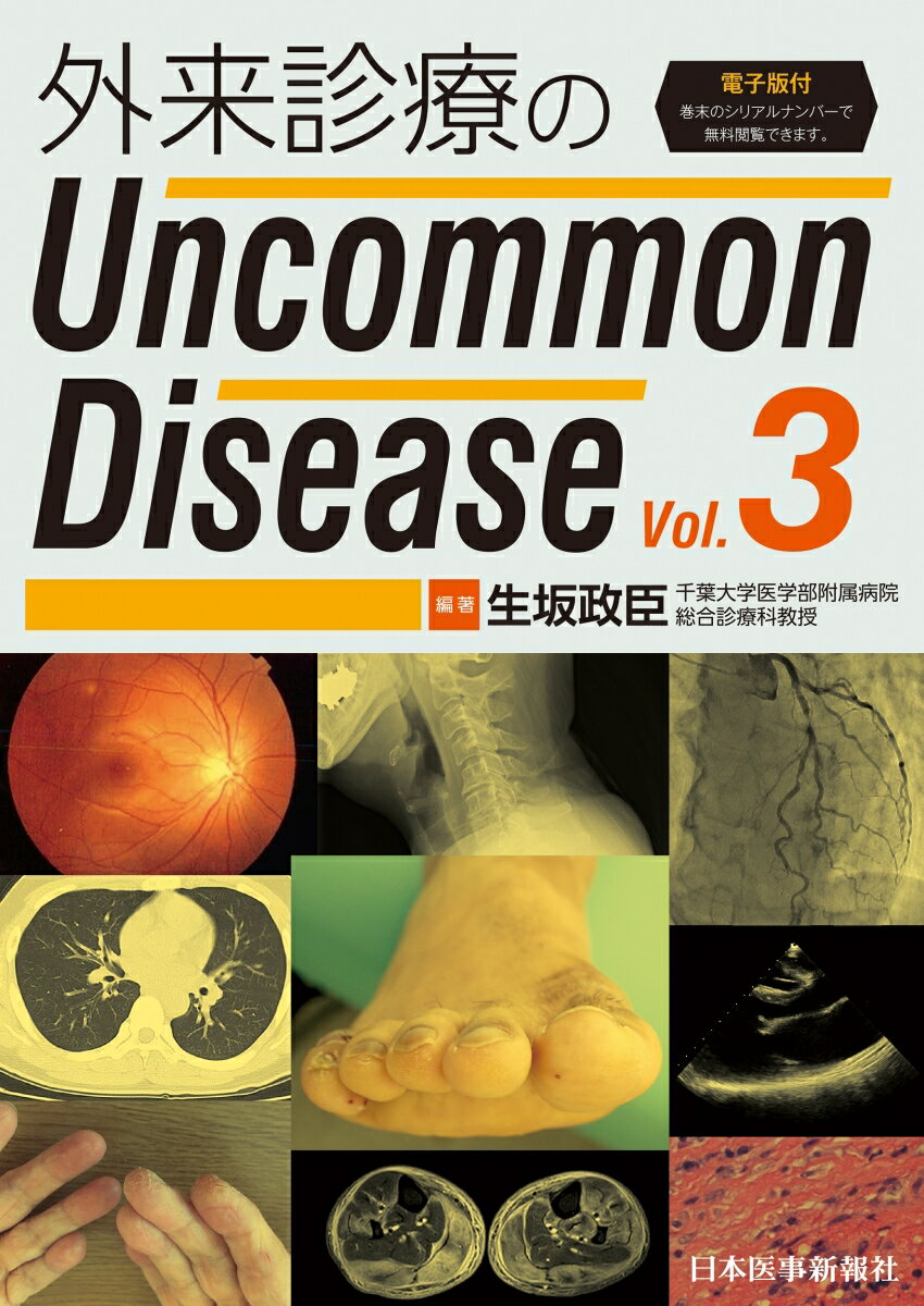 外来診療のUncommon Disease vol.3【電子版付】 生坂政臣