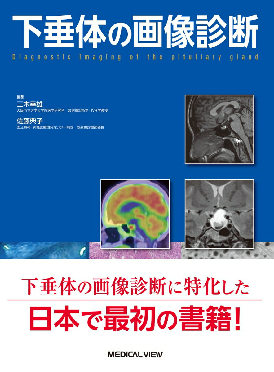 下垂体の画像診断 [ 三木　幸雄 ]