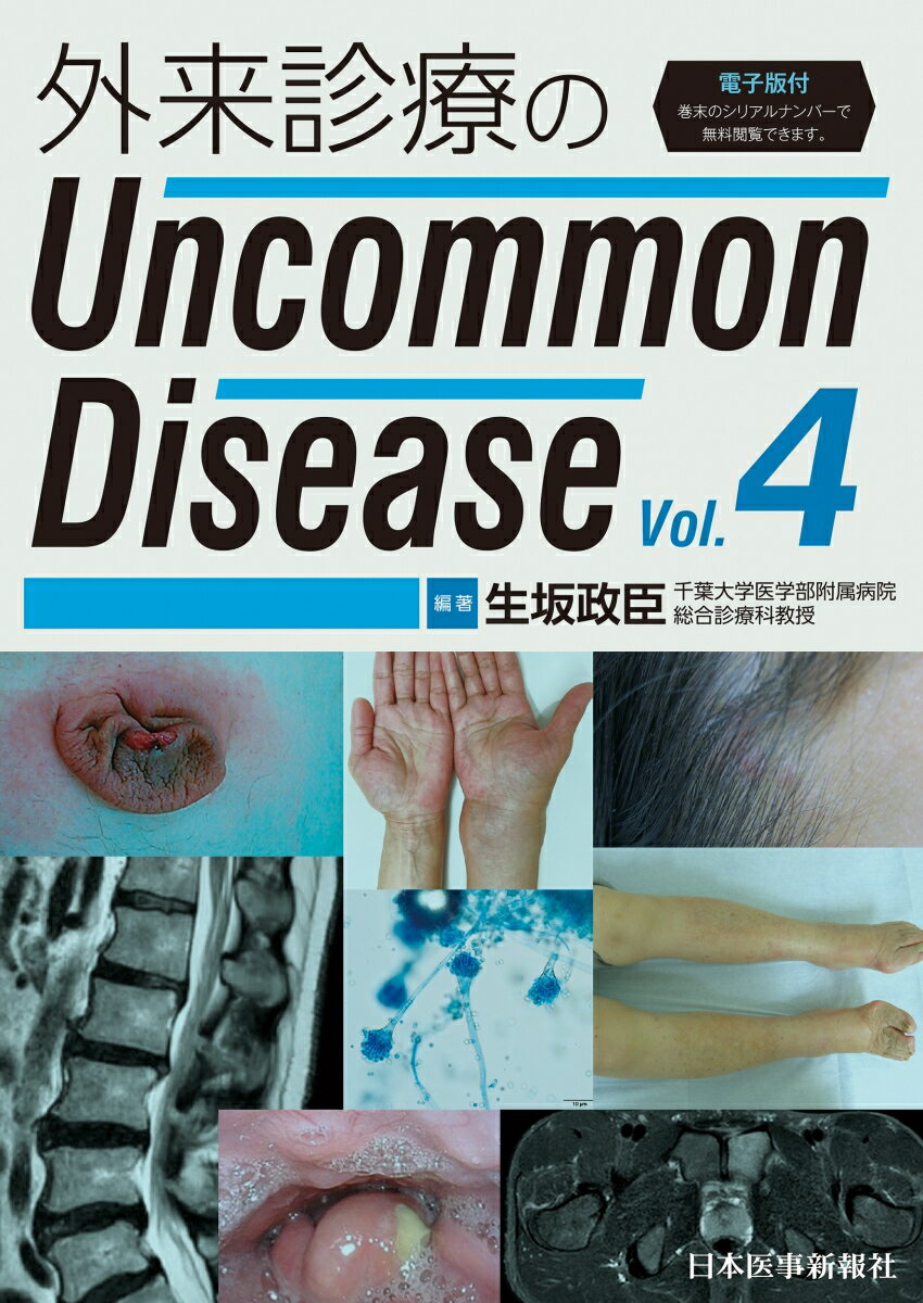 外来診療のUncommon Disease vol.4 生坂 政臣