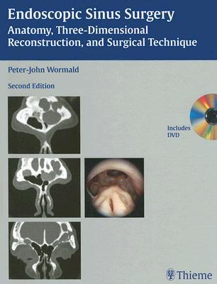 Endoscopic Sinus Surgery: Anatomy, Three-Dimensional Reconstruction, and Surgical Technique [With DV ENDOSCOPIC SINUS SURG-2E W/DVD [ Peter-John Wormald ]