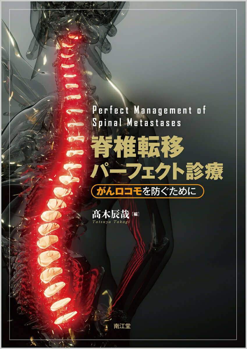 脊椎転移パーフェクト診療 がんロコモを防ぐために [ 高木　辰哉 ]